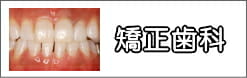 矯正歯科治療