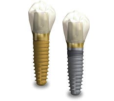 implant_p01