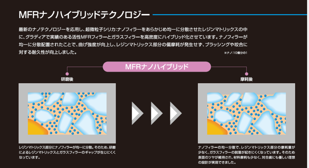 コンポジットレジン治療は保険でできます あきる野市の年中無休の歯医者 きらら歯科