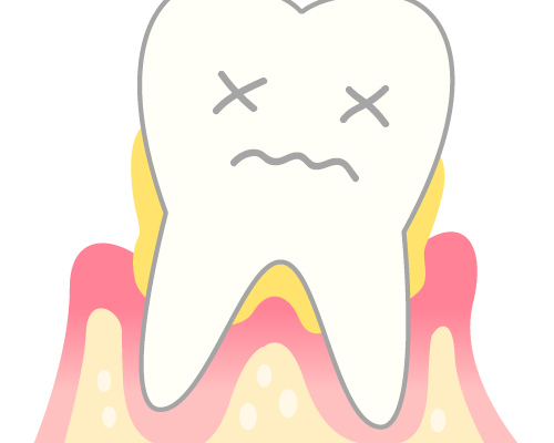 舌みがきで口臭予防 あきる野市の年中無休の歯医者 きらら歯科