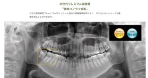 正確な診断