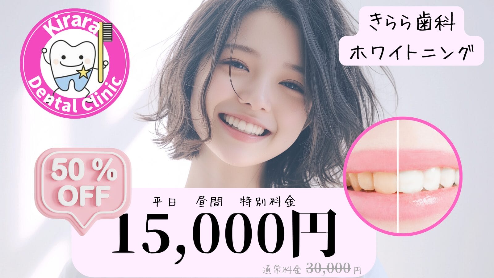 ホワイトニング平日昼間スタート限定特別価格 15,000円(50%OFF)男性も 