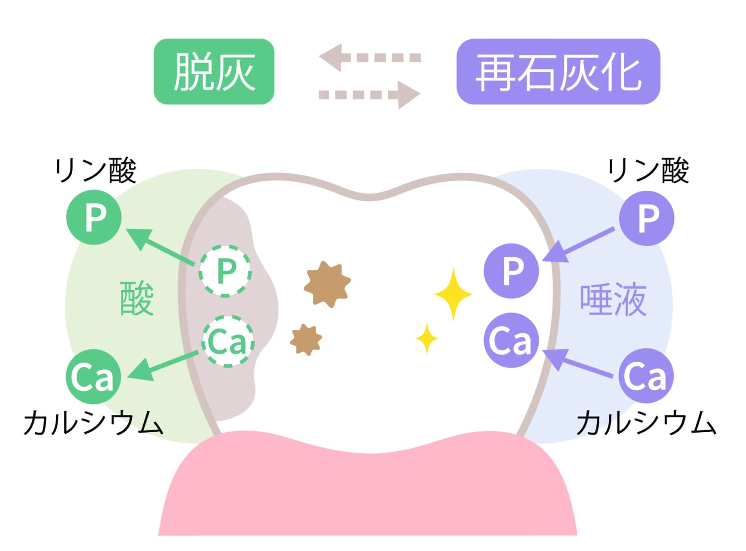 再石灰化脱灰　虫歯　フッ素