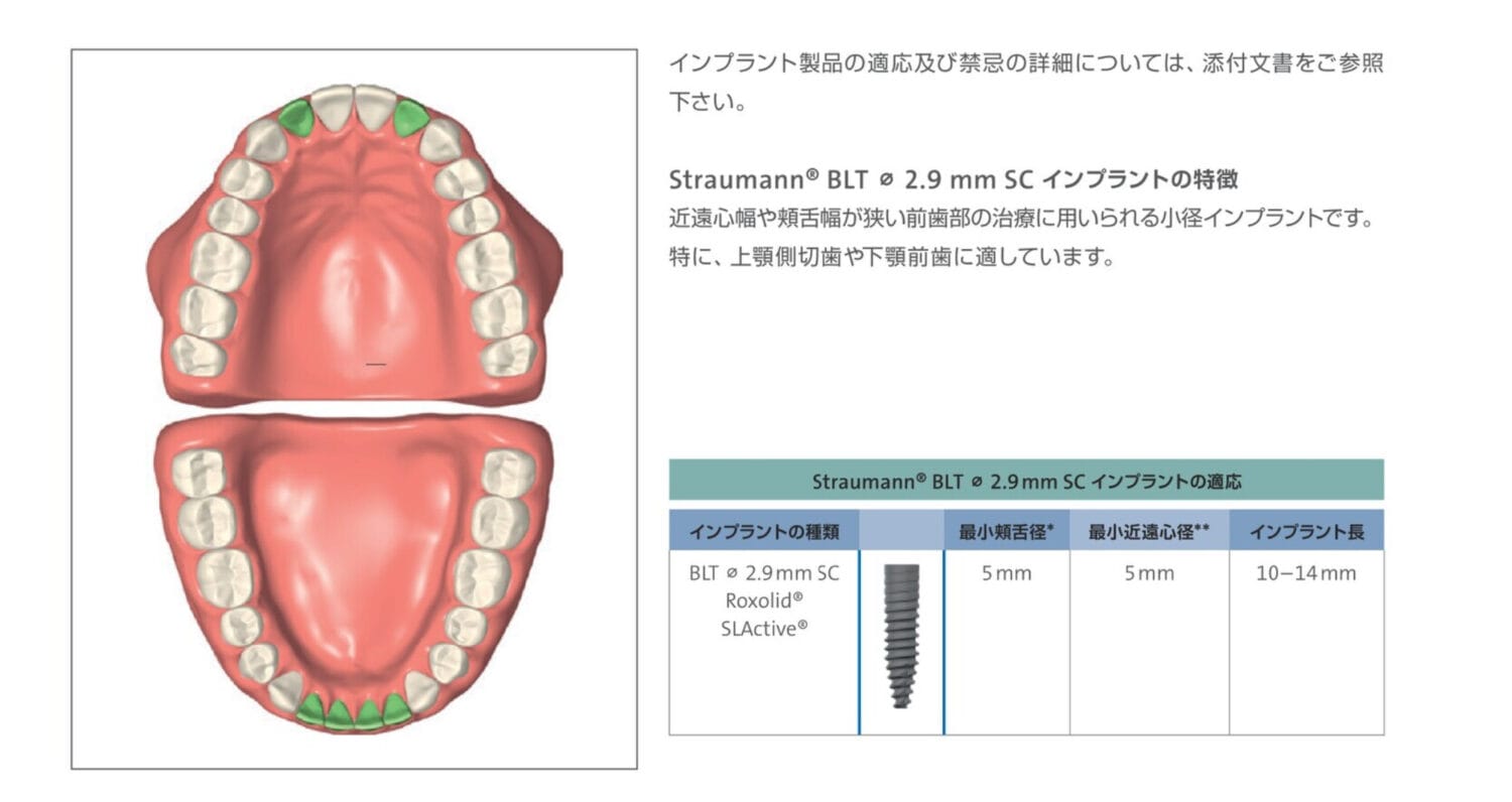 ストローマンインプラント