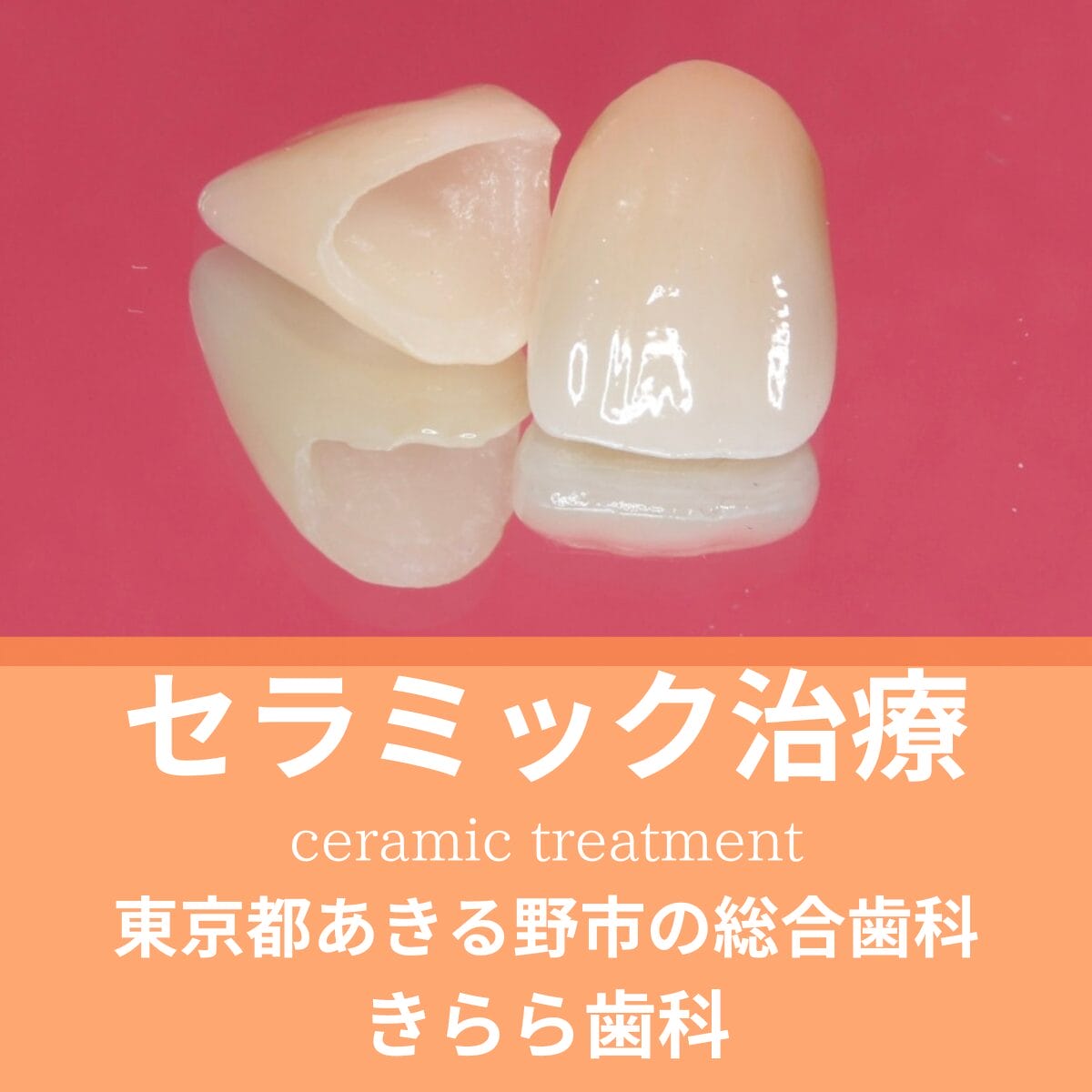 セラミック治療