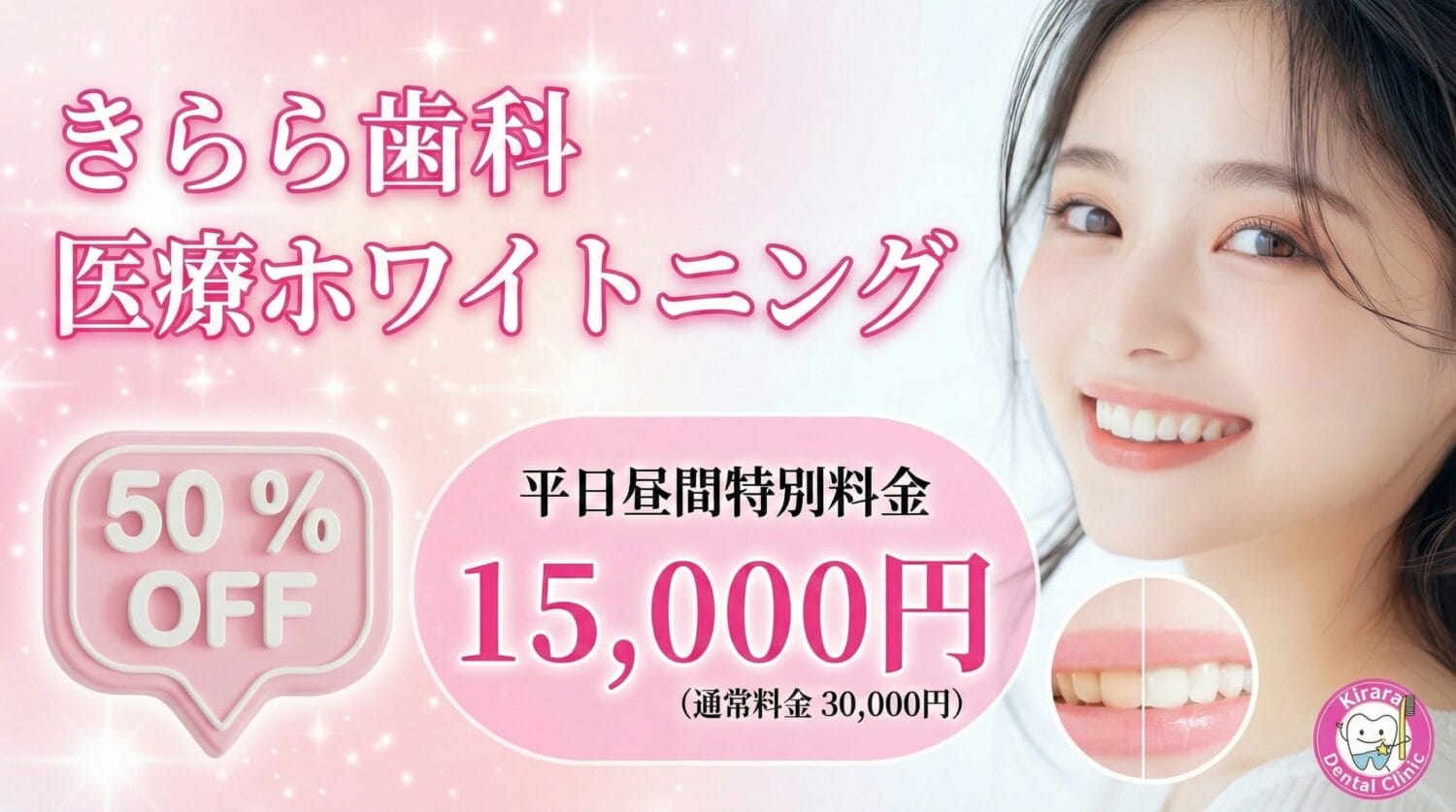 ホワイトニング｜歯を白くしたい | きらら歯科【秋川駅・年中無休・朝7 