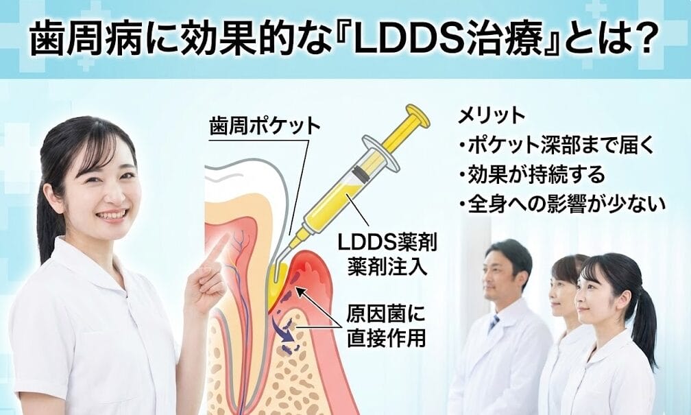 歯周病治療に効果的なLDDS治療とは
