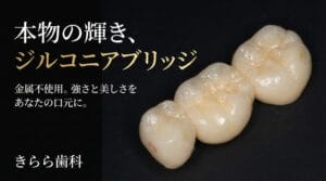 ジルコニアブリッジ