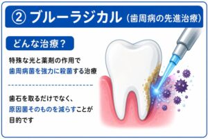 ブルーラジカル　歯周病