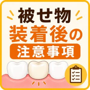 被せ物装着後の注意事項　アイキャッチ画像