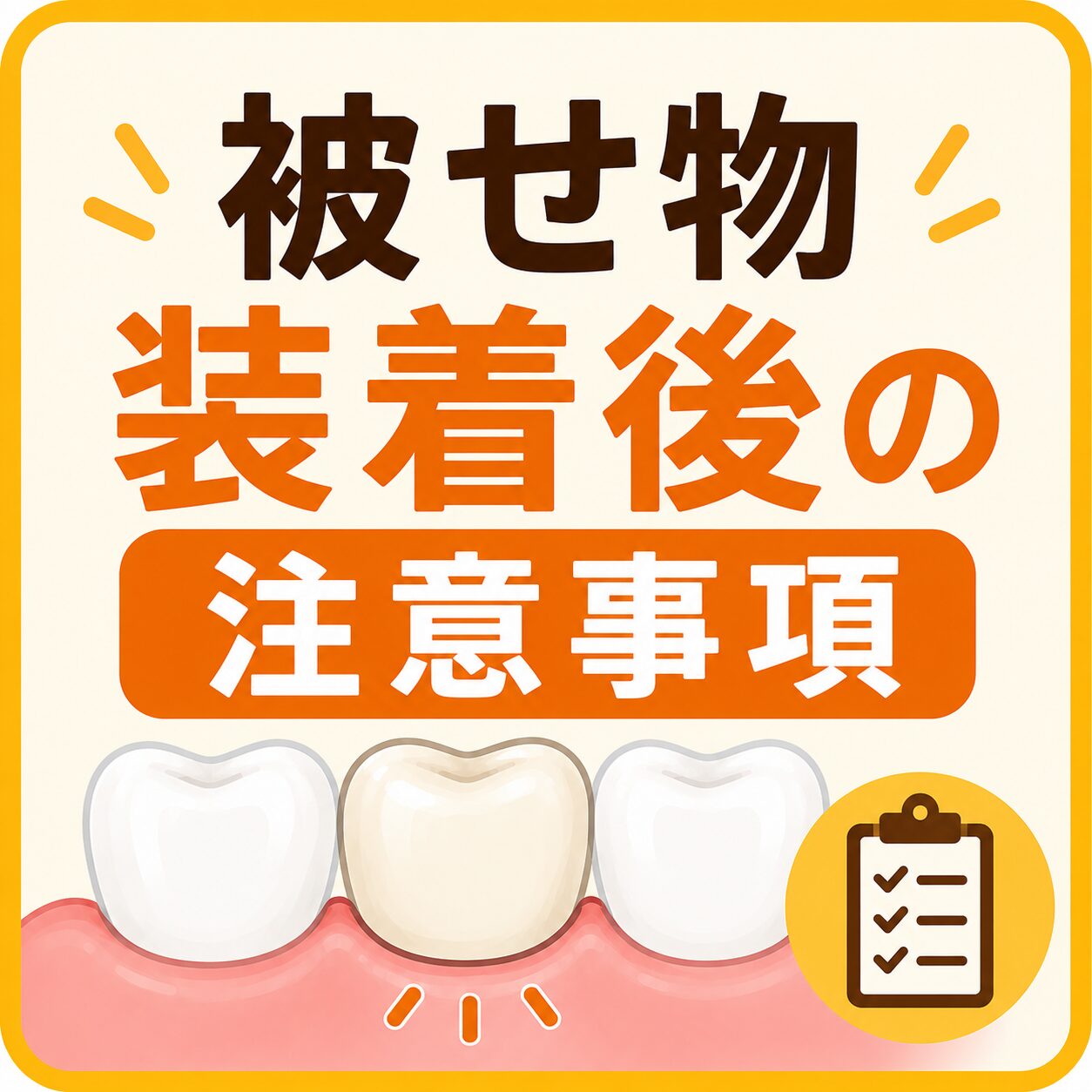 被せ物装着後の注意事項　アイキャッチ画像