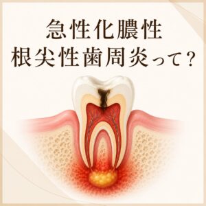急性化膿性根尖性歯周炎　アイキャッチ画像