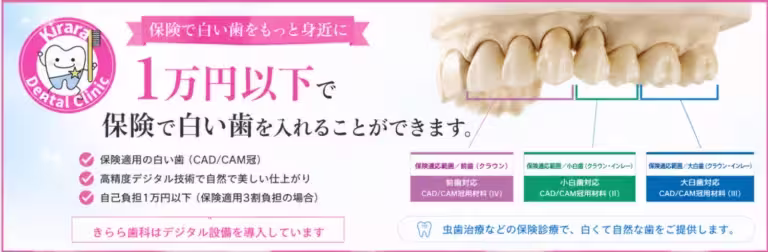 保険で白い歯の治療